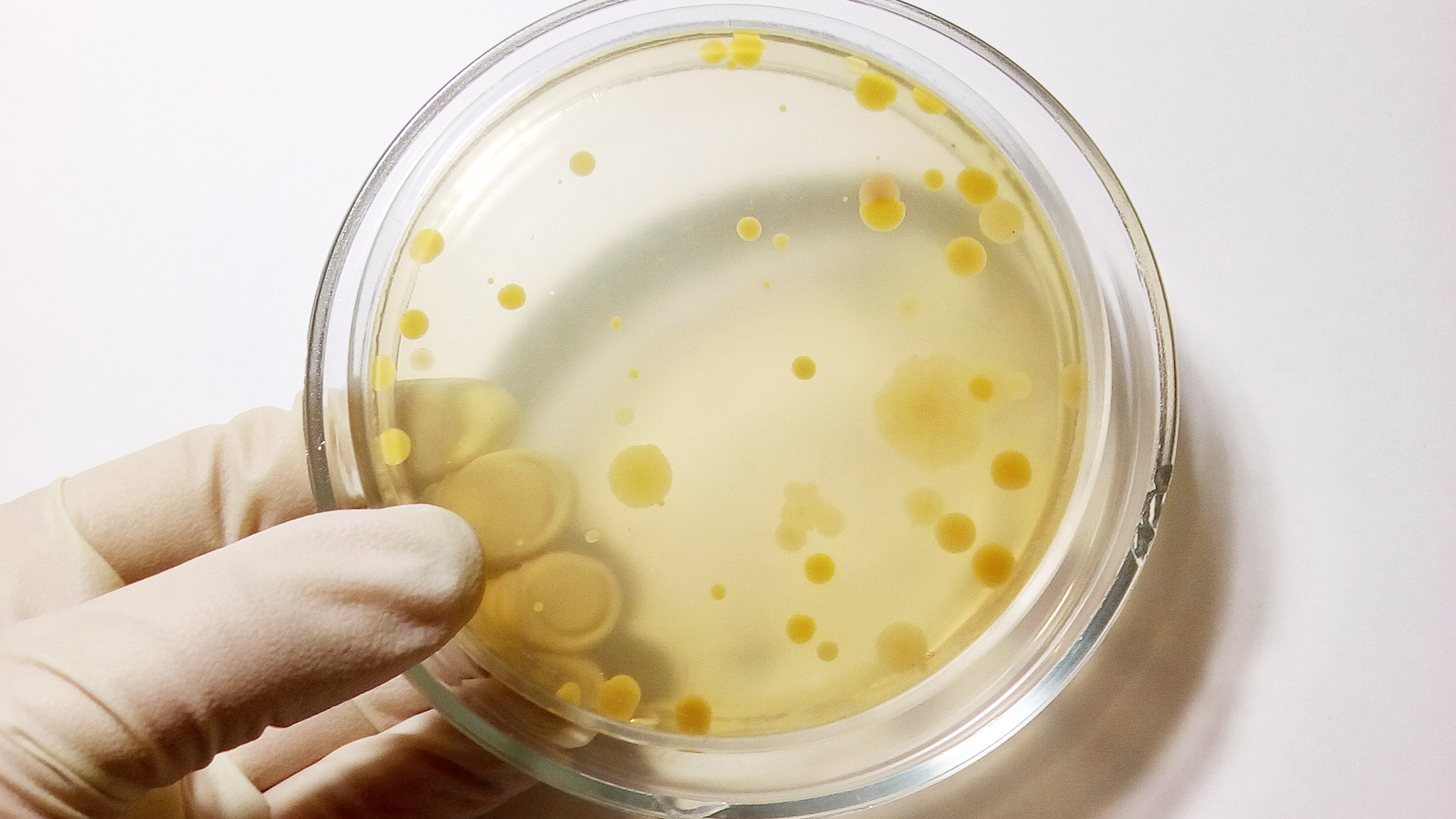 The Power of Air Sampling: How My Long Island Mold Removal Uses Advanced Techniques to Detect Invisible Mold Spores and Airborne Pollutants in Your Home